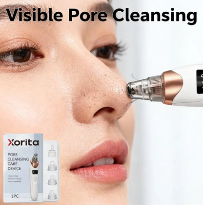 5-Level Facial Pore Vacuum